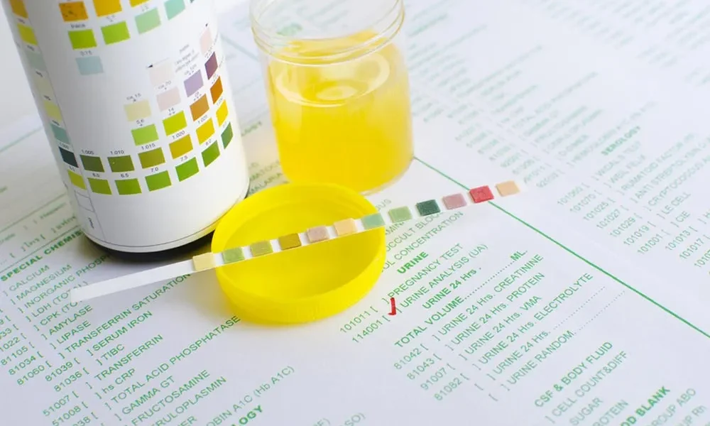 The Importance of Correct pH and Specific Gravity in Synthetic Urine